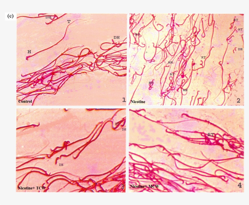 Effect Of Cosupplementation Of Tender And Mature Coconut - Art, transparent png