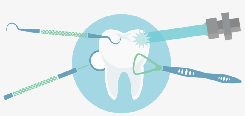 Occasionally A Cavity Will Be Placed On “watch” Instead, transparent png