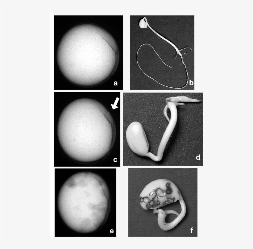 Soybean Seed Images Obtained By X-ray Test And Related - X Ray Seed Test, transparent png