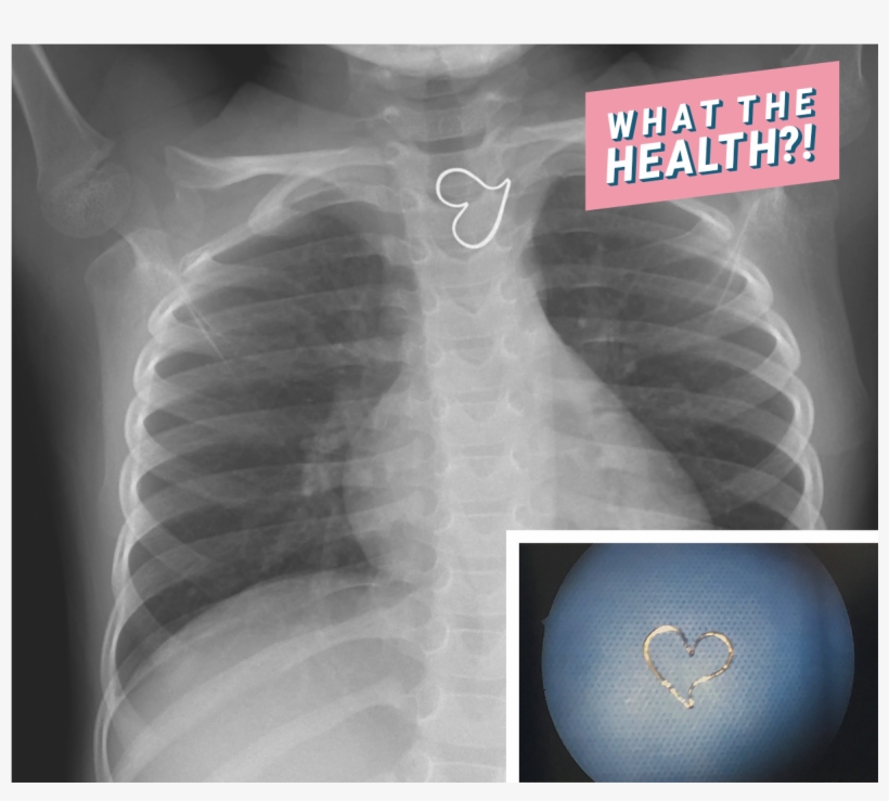 X-ray Heart Medical Doctor Hospital Found Woman Health - Heart, transparent png