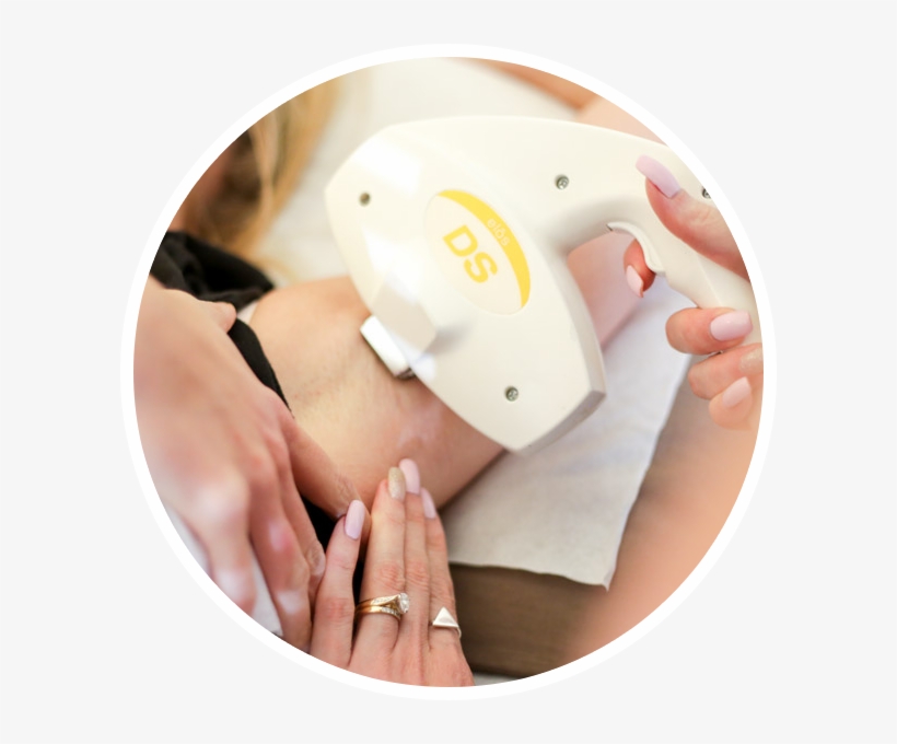 Intensive Pulse Light Ipl Permanent Hair Reduction - Circle, transparent png