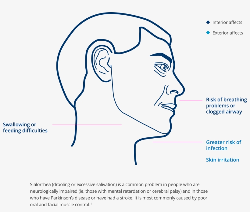 References - Diagram, transparent png