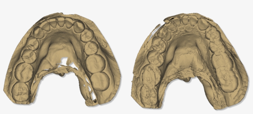File - Maestro - 3d - Easy - Dental - Scan - Calibration - Scanner 3d Dentale, transparent png