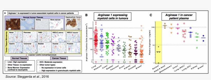 Arginase Expression 2 - Arginase 1 In Tumors, transparent png