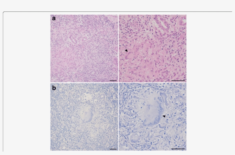 A Hematoxylin And Eosin Staining - Tile, transparent png
