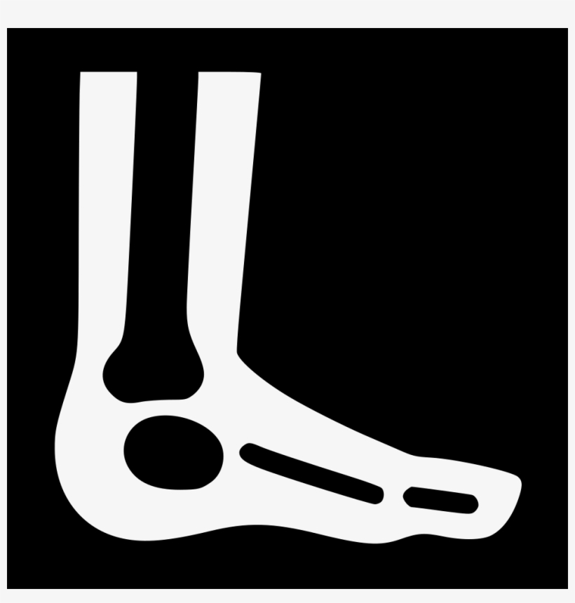 Foot X Ray Comments - Foot, transparent png