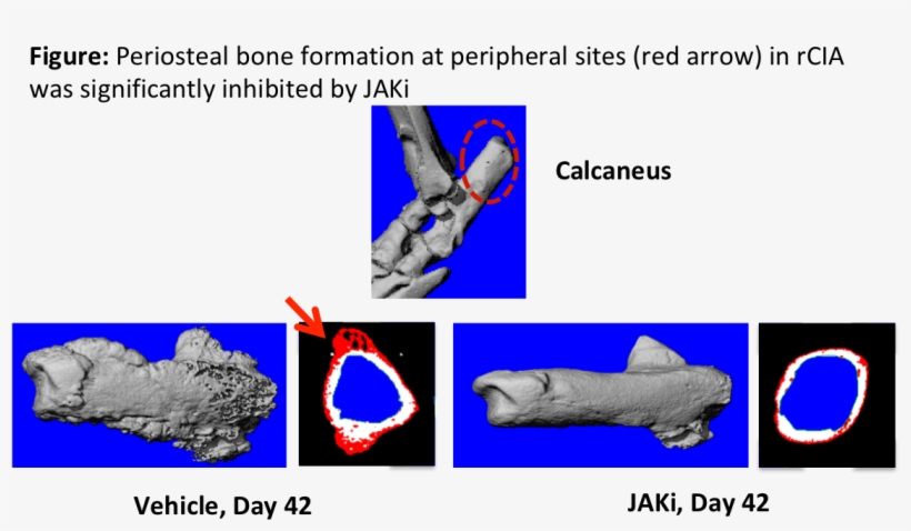 Schett G, Arthritis Rheum, - Art, transparent png