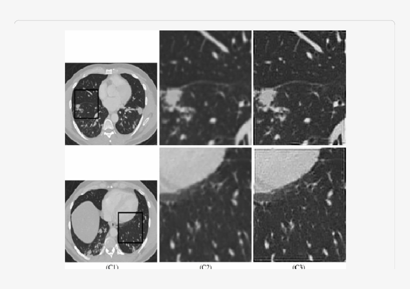 Processing Naturally Blurred Ct Images - Monochrome, transparent png