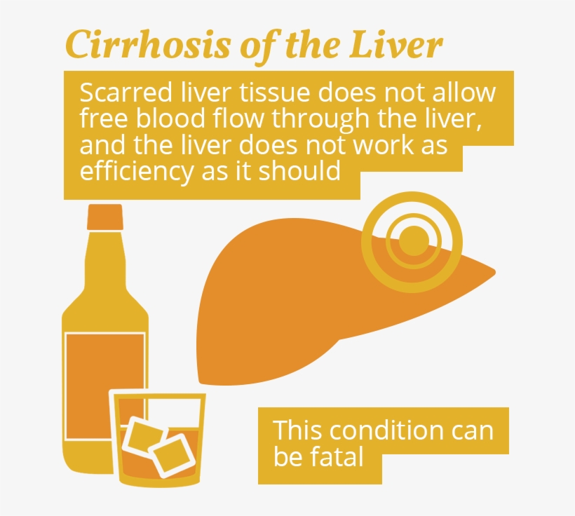 Cirrhosis And Alcohol Use, transparent png