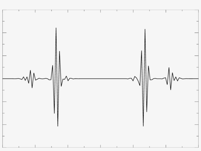 A Typical Result For A Cut Of The Far Field Amplitude - Diagram, transparent png