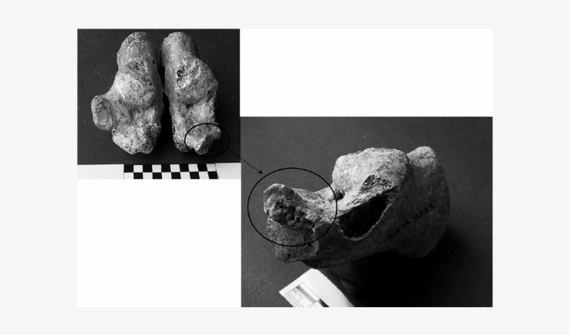 Left And Right Calcanei Of The Adult Female Skeleton - Monochrome, transparent png