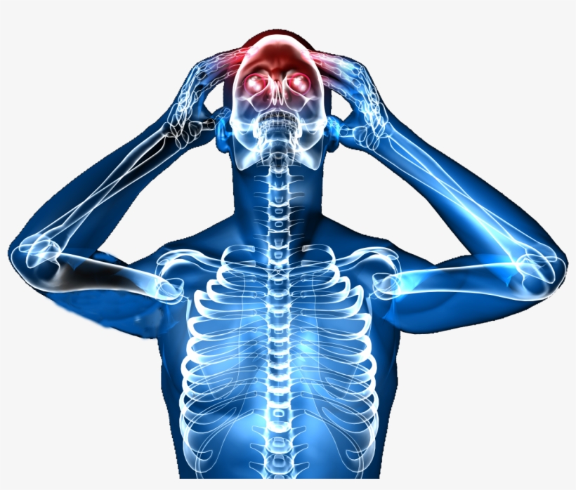 Define Headaches - Headache, transparent png