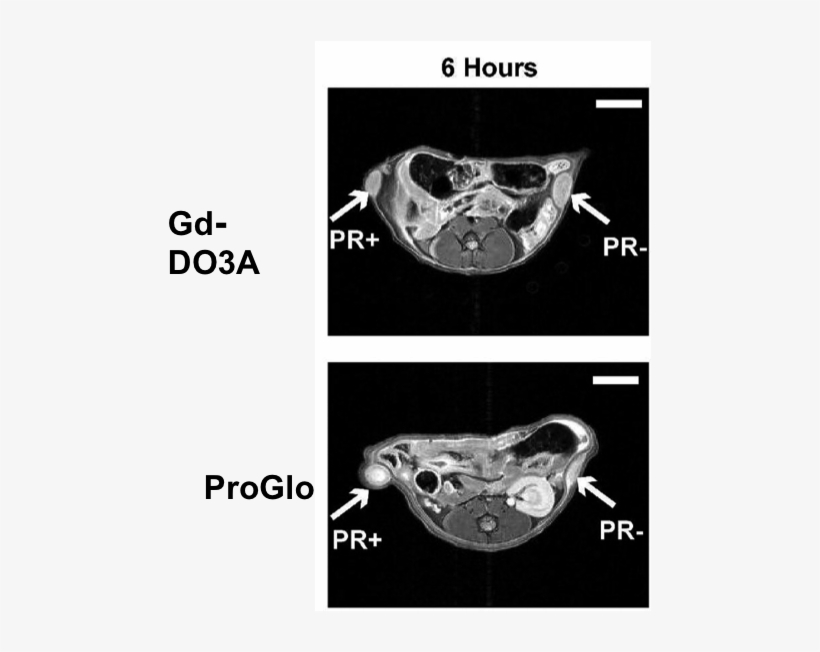 Bilateral Flank Tumors Were Grown In A Mouse Model - Kevingston Rugby, transparent png