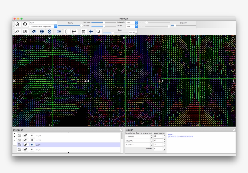 We Have Only Shown The Results For V1 Here, As The, transparent png
