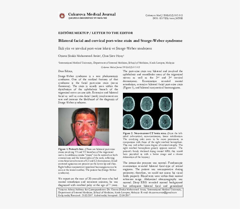 Pdf - Port Wine Stain Vasculogenesis, transparent png