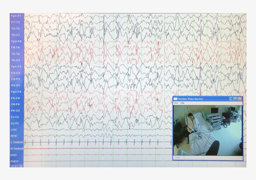 Eeg - Handwriting, transparent png