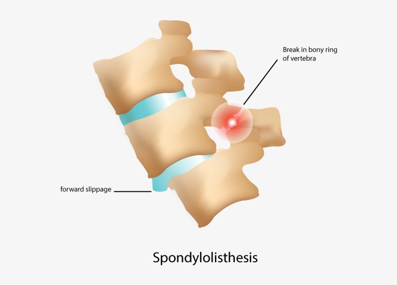 Zeeshan Sardar, Md - Pet An Animal, transparent png