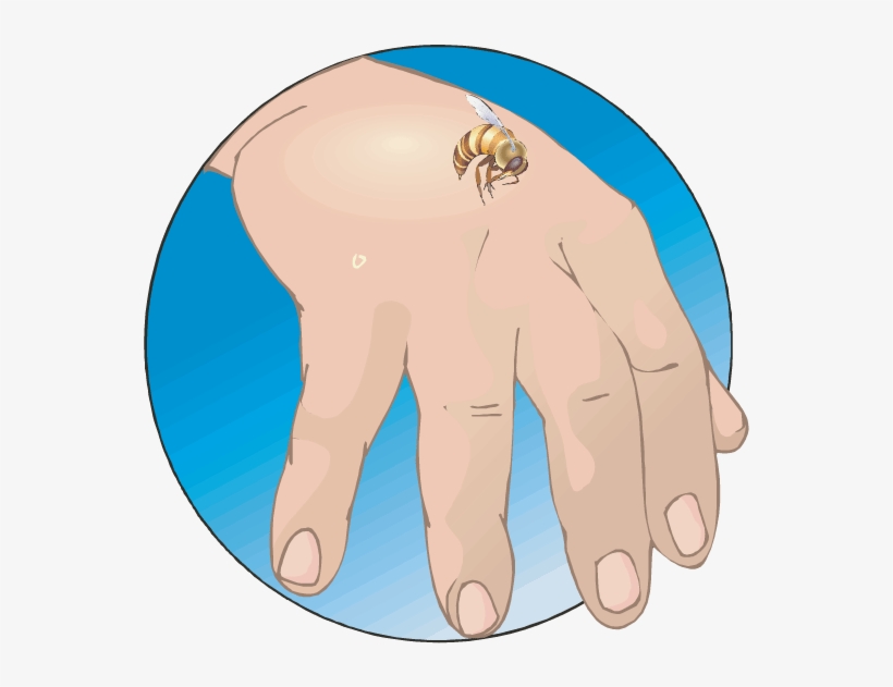 Bees Do Not Sting As An Aggressive Act - Bee Stings Allergic Reactions, transparent png