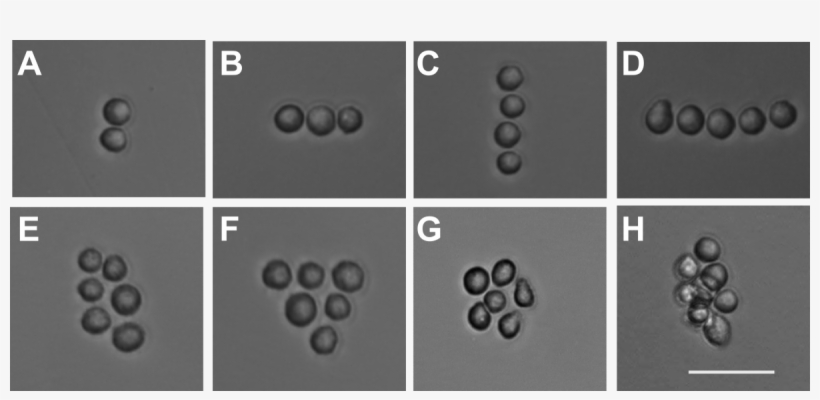 Micrographs Of Cells Arranged In Straight Lines, Globs - C Kit Stain Heart, transparent png