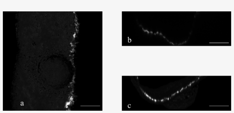 3-d Presentation Of A Laser Ablation Cavity (vsp, 28 - Radiology, transparent png