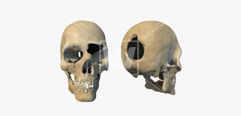 Head Shot Damaged Skulls - Skull, transparent png
