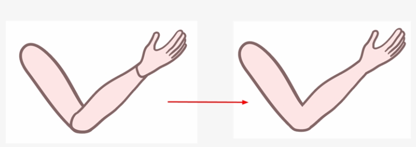 The Auto Patch Node Is Used Mainly When Creating Joint - Documentation, transparent png