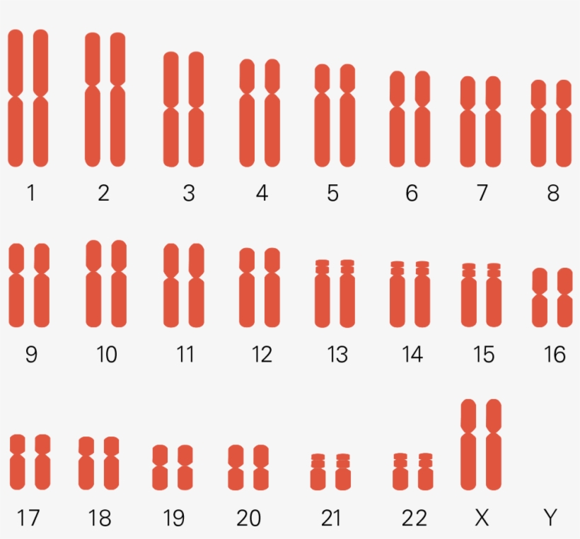 Chromosomes - Turner Syndrome Karyotype Chart, transparent png