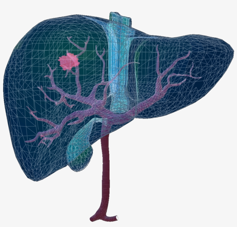 At The Global Liver Tumor Segmentation Challenge That - Butterfly, transparent png