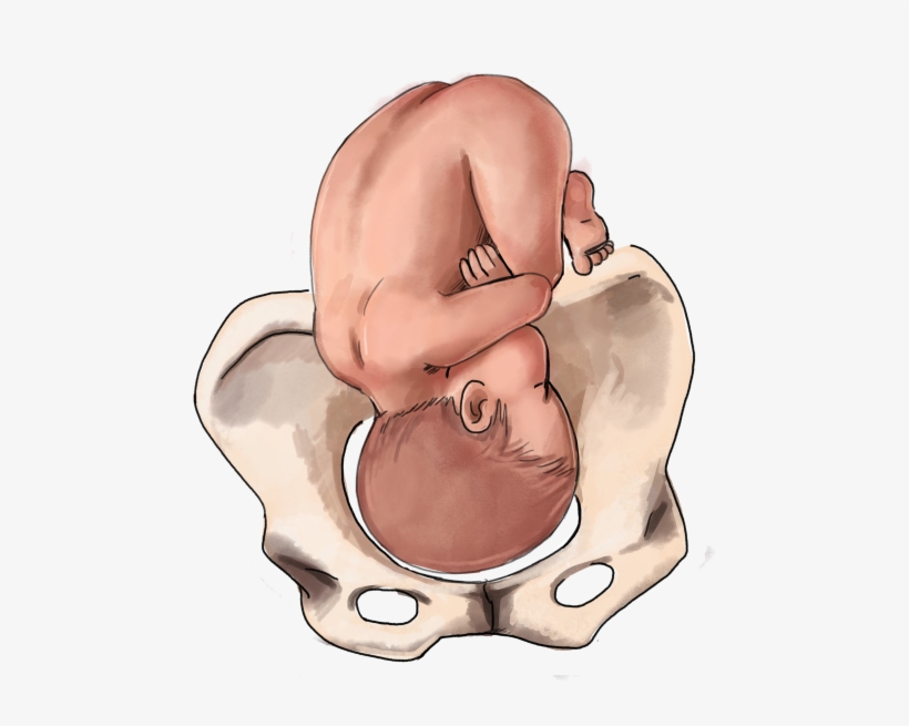 Roa Baby Position - Frank Breech, transparent png