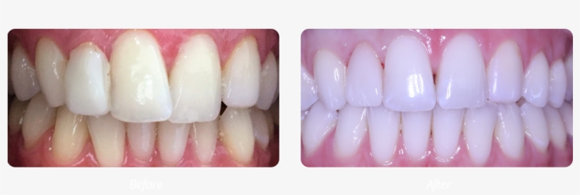 Manicure, transparent png