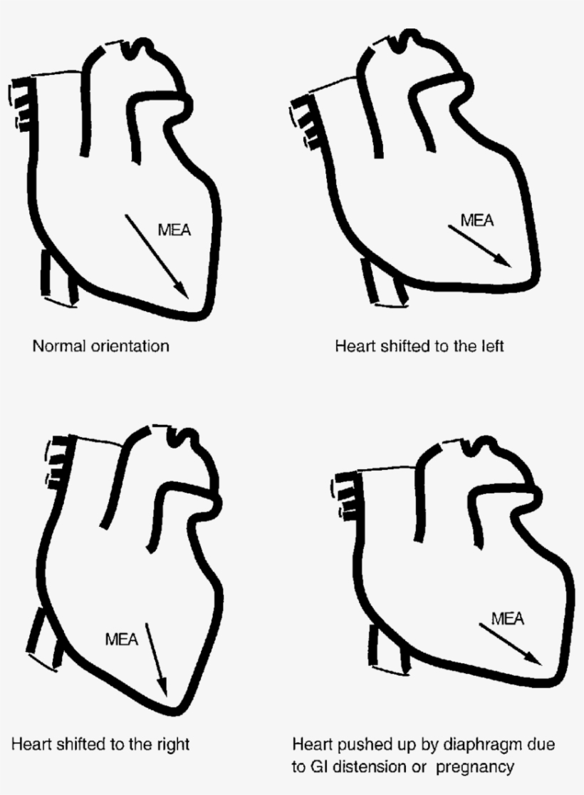 Demonstration Of How The Position Of The Heart In The - Line Art, transparent png