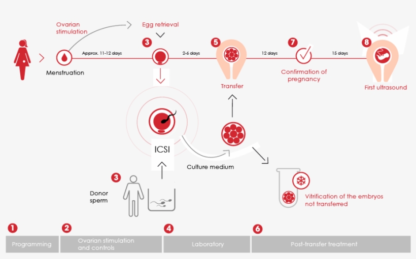 Gráfico De Fases De Fiv-icsi Con Semen De Donante - Fécondation In Vitro Icsi, transparent png