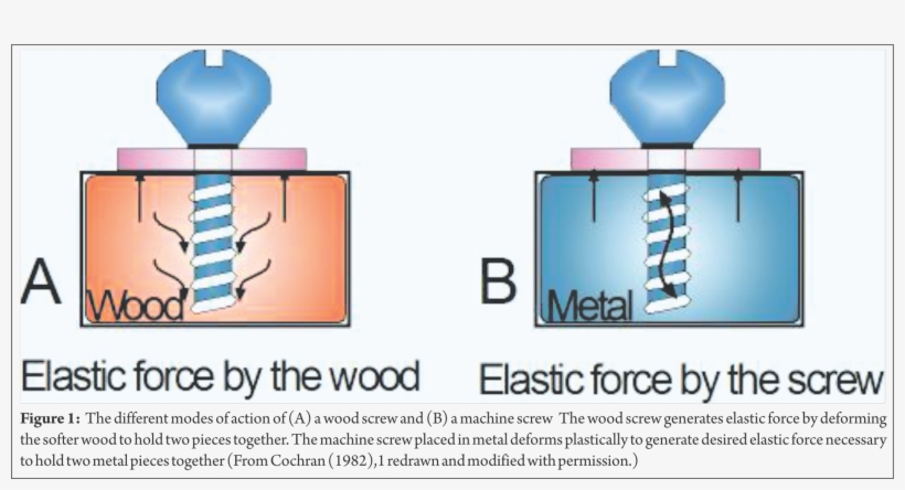 Biomechanics Of Cancellous Screw Trauma International - Graphic Design, transparent png