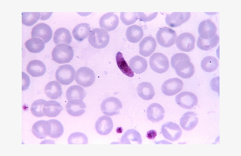 Request Pricing Info - Plasmodium Falciparum Microgametocyte, transparent png