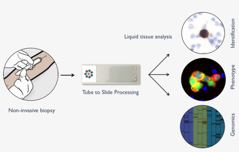 Ctcs Can Be Detected In Peripheral Blood Using A Simple, - Circle, transparent png
