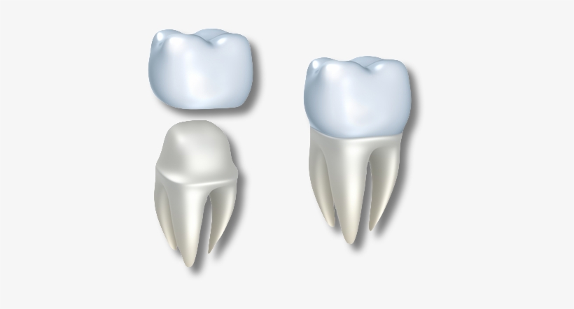 Dental Crown Transparent, transparent png