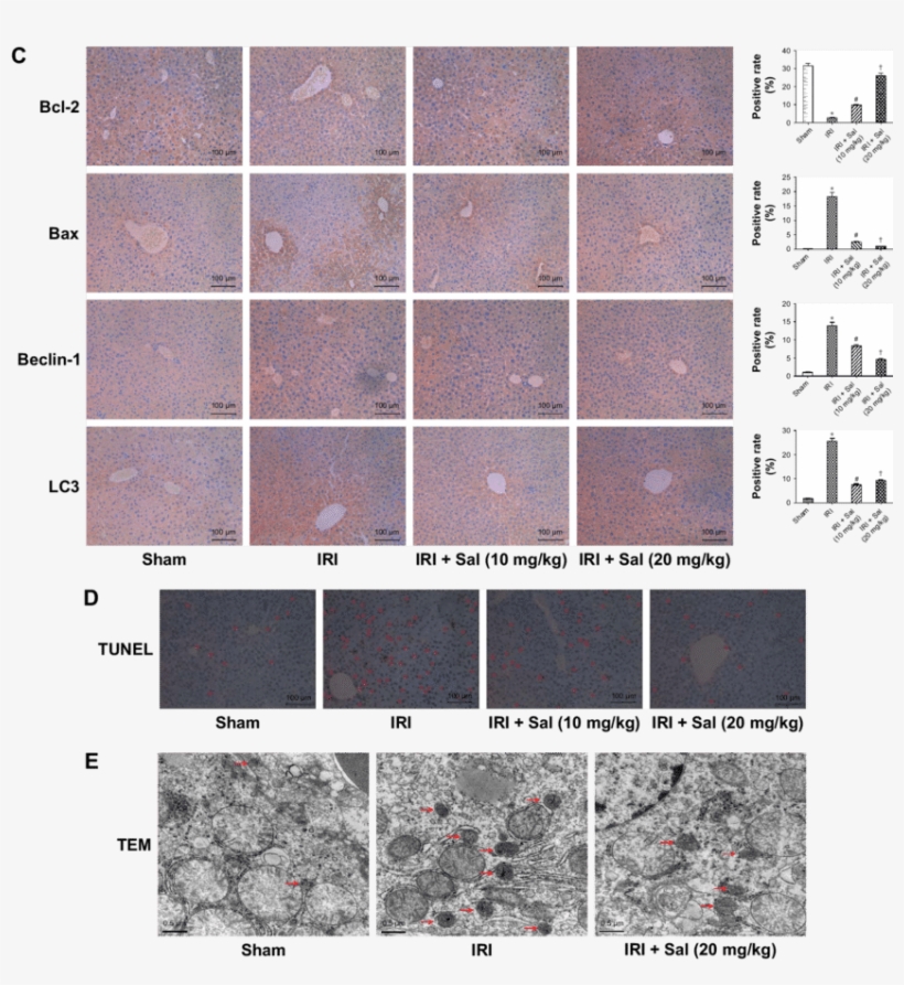Sal Pretreatment Ameliorates Apoptosis And Autophagy - Tile, transparent png