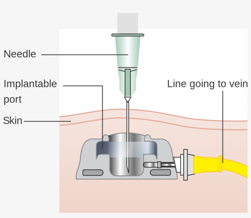 To Help Better Understand And Get A Visual Of What - Diagram, transparent png