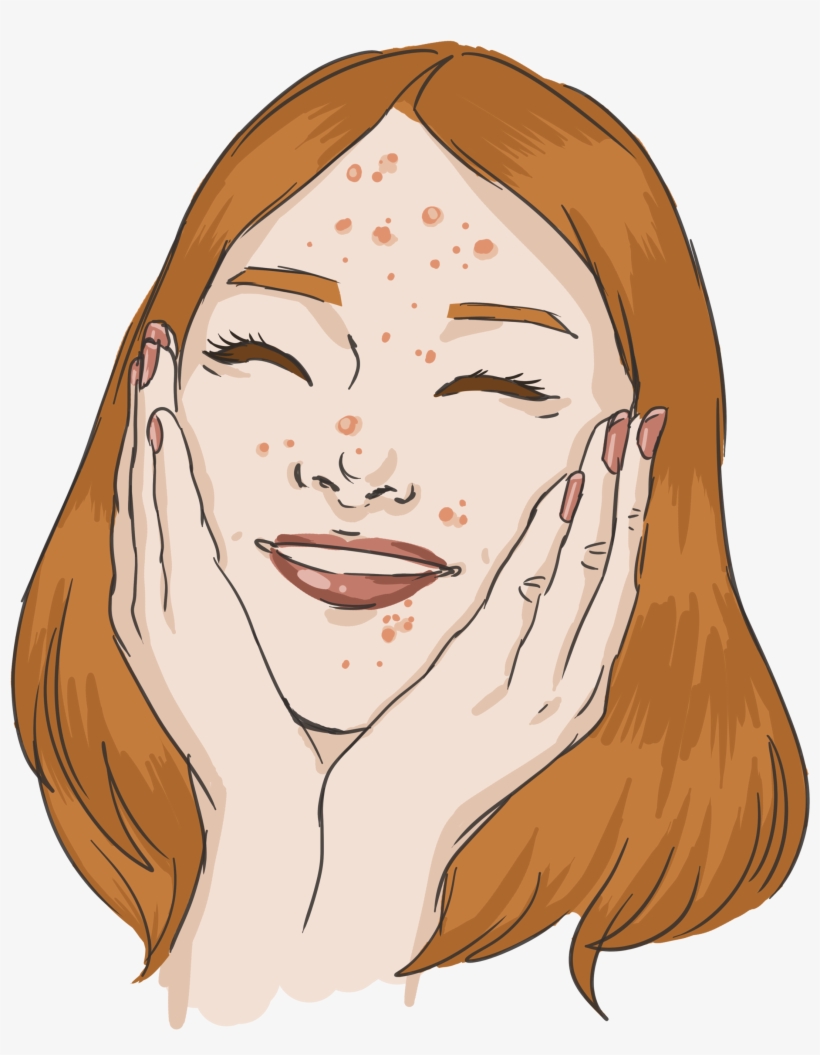 Your Pimples Are Cute, transparent png