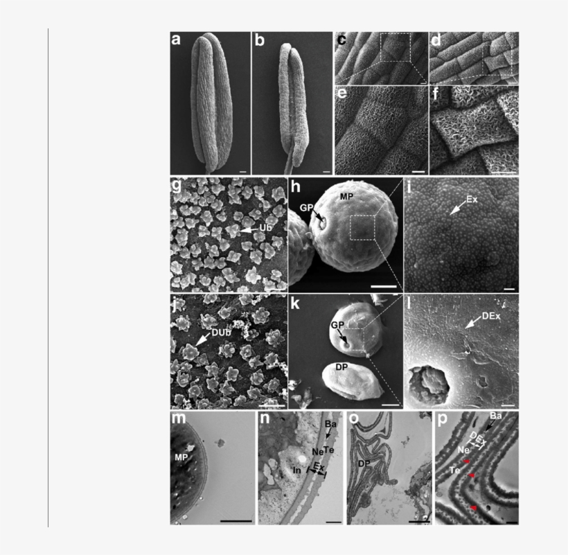 Sem And Tem Observation For The Wt And Oslap6 Anther - Monochrome, transparent png