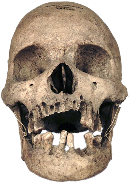 Real Skull, Calavera, Craneo, Skull Png And Psd - Real Skull (640x640), Png Download