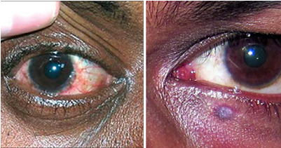 Eyes - Eye (1100x384), Png Download
