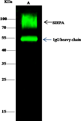 Anti-sirp Alpha Antibody Images - Signal-regulatory Protein Alpha (408x501), Png Download