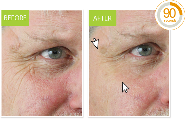 Neutratone® Combines The Latest Breakthrough Science - Neutratone (639x411), Png Download