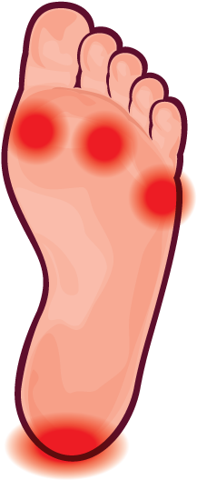 Callus - Callus Png (600x600), Png Download
