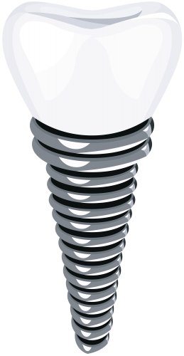 Dental Implant Png Clip Art - Implant Png (259x500), Png Download