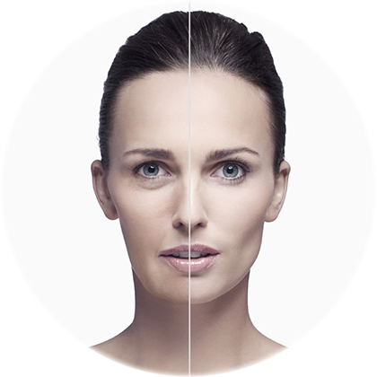 Facial Flaccidity - Ex1 Cosmetics Invisiwear Liquid Foundation 30ml (various (420x420), Png Download