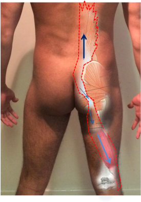 Deep Longitudinal Sling - Deep Longitudinal System (300x438), Png Download