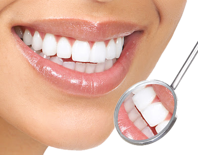 White Teeth Transparent Background - Ihealthia Sonic Replacement Toothbrush Heads For Philips (400x312), Png Download