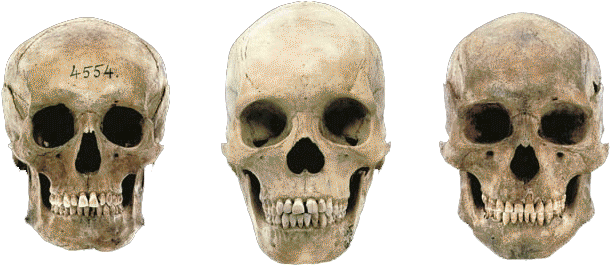 Variations In Modern Human Skulls - German Male Skull (650x288), Png Download